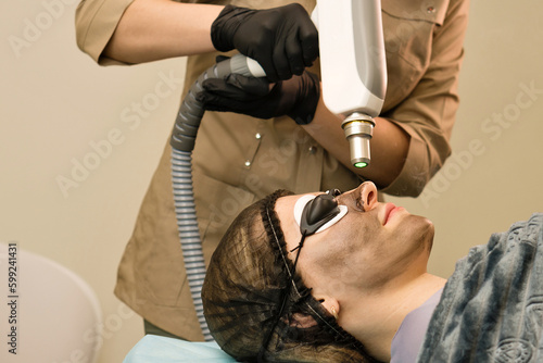 Facial carbon peeling procedure