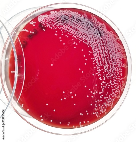 Nonhemolytic colonies on 5% sheep blood agar. Bacteria colonies in petri dish, blood agar.