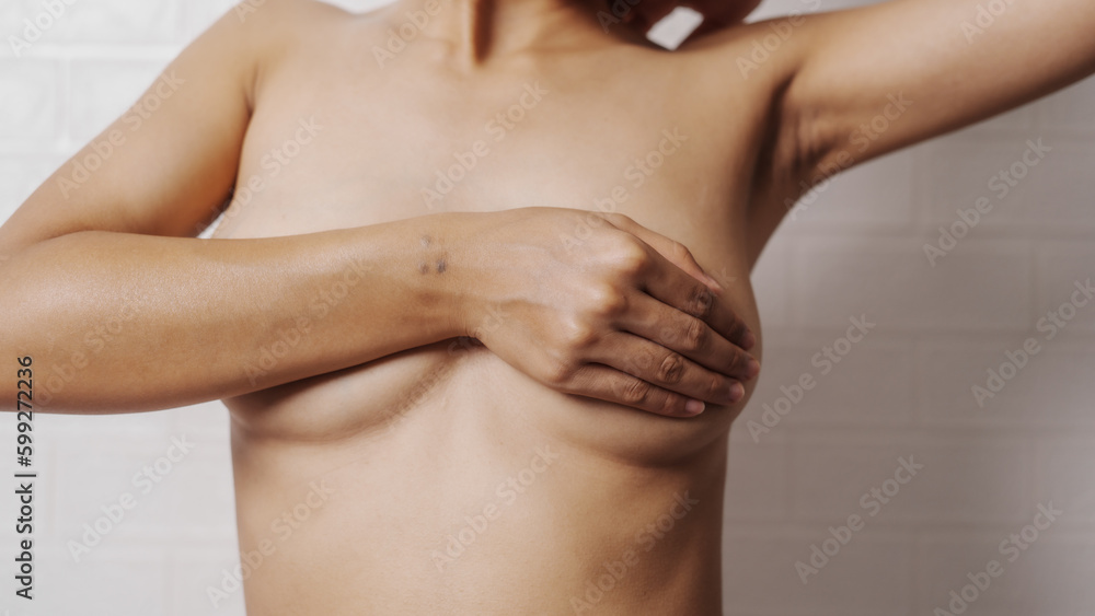 Young asian woman examining breast mastopathy or signs of breast cancer, Closeup Sexy Topless Naked Female With Breast Cancer Awareness