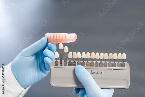 Dental technician hold palette of shades of teeth scale. Close up of shade guide to check veneer of tooth crown in a dental laboratory.
