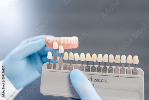 Close up of shade guide to check veneer of tooth crown in a dental laboratory. Dental technician hold palette of shades of teeth scale.