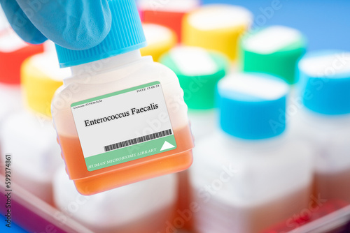 Enterococcus Faecalis photo