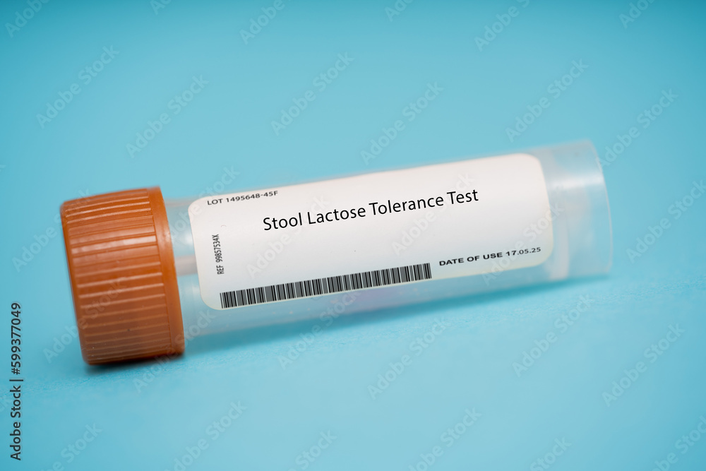 Stool Lactose Tolerance Test Stool Lactose Tolerance Test
