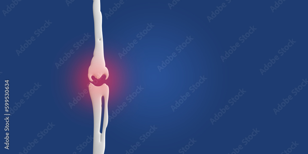 Bone foot human leg of part person people skeleton ankle anatomy body medical joint medicine toe pain woman man biology physician science health care sport treatment ache barefoot xray finger disease Bone foot human leg of part person people skeleton ankle anatomy body medical joint medicine toe pain woman man biology physician science health care sport treatment ache barefoot xray finger disease