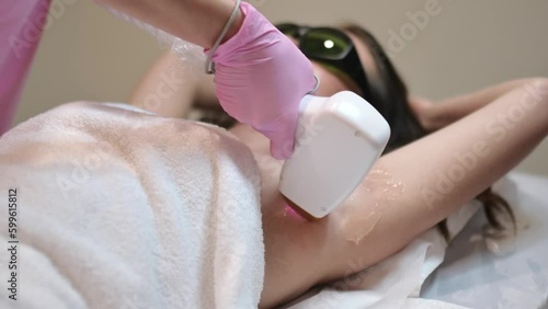 Body care concept. Laser epilation. A young caucasian woman in protective glasses lies on the couch, a female beautician doing laser hair removal in the armpit area, hair removal in a beauty salon