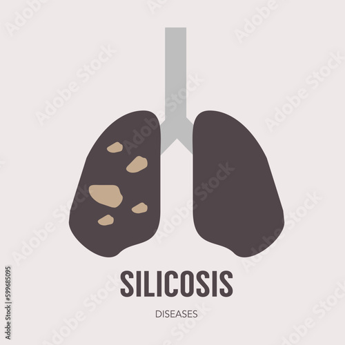 Silicosis disease flat design. Medical and healthcare concept. Lung disease