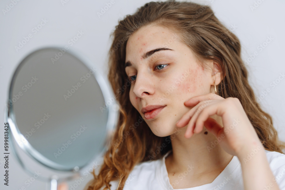 Young woman with problem skin looking into mirror. Dermatology. Allergic reaction from cosmetic, red spot or rash on face. Beauty care. Young woman with problem skin looking into mirror. Dermatology. Allergic reaction from cosmetic, red spot or rash on face. Beauty care.