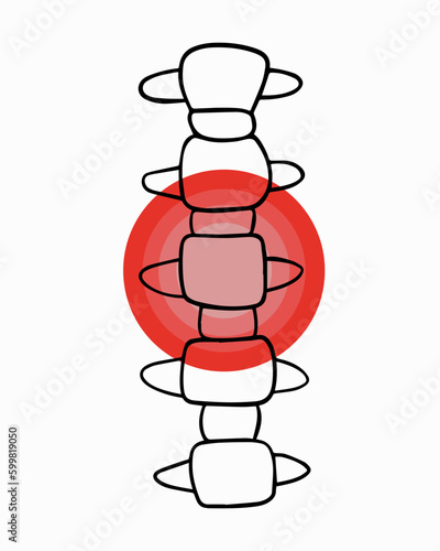 Vector isolated illustration of cervical vertebrae pain. Contour drawing of the cervical region with localization of pain in the vertebrae.