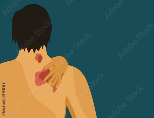 The man has alergic itching, skin inflammation, redness and irritation. 