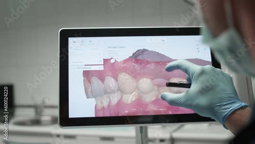 A professional dentist man looks at a 3d model of teeth on a computer monitor. Dental consultation, diagnostics. Jaw scan, digital imprint, medical digital technology