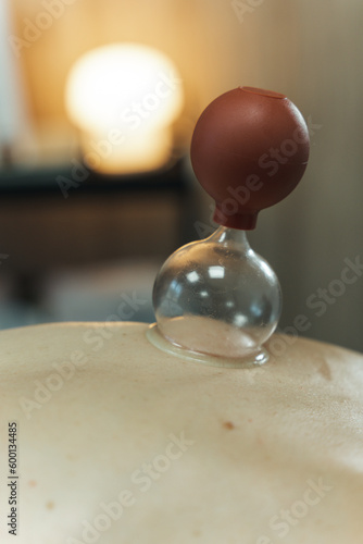 Cupping massage therapy, silicone cupping, close up on female back in clinic center