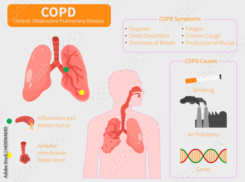 human Lungs vector clip art icon. COPD vector illustration, chronic obstructive pulmonary explanation