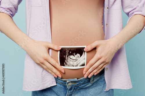 Cropped young pregnant future mom woman with belly tummy wearing casual clothes holding show ultrasound image pregnant baby photo isolated on plain pastel blue background. Maternity pregnancy concept.