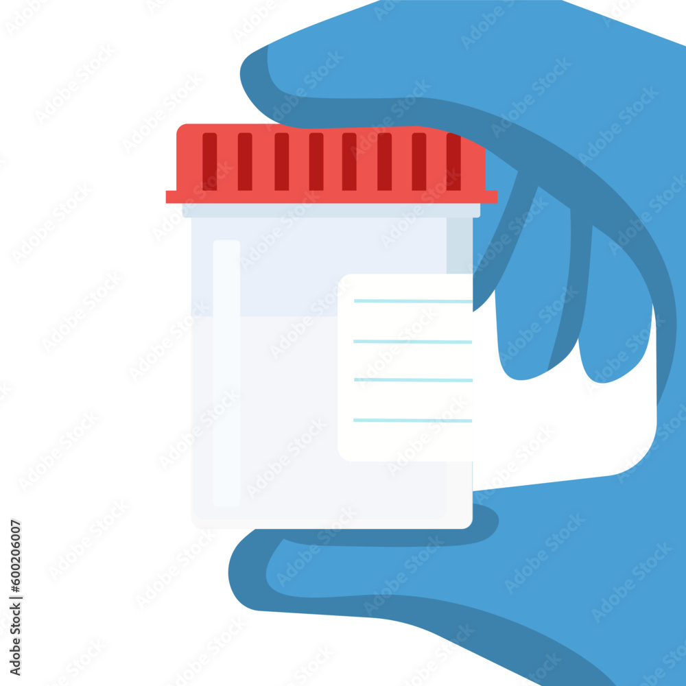 Flat design of sperm test for medical and healthcare. Illustration for websites, landing pages, mobile applications, posters and banners. Trendy flat vector illustration