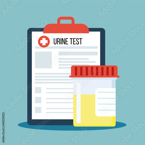 Flat design of urine test for medical and healthcare. Illustration for websites, landing pages, mobile applications, posters and banners. Trendy flat vector illustration