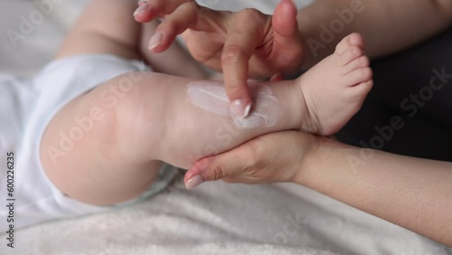 mother hand using cream from jar to apply on baby new born infant legs.child with eczema or dermatitis red spots on foot. rash or kid allergy on body.woman hand massaging putting cream on dry skin 4k 