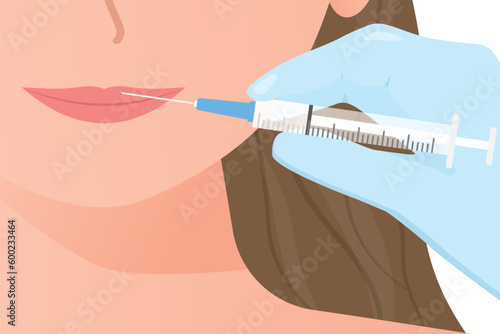 lips injection for increase shape; aesthetic medicine clinic concept- vector illustration