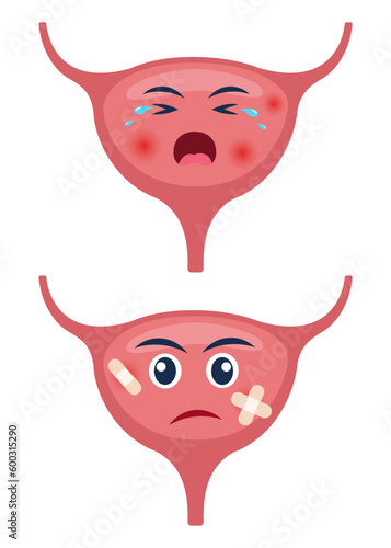 Sick bladder with pain ache or disease. Sad cartoon character bladder, body organ injured or unhealthy. Human cartoon anatomy, kids medicine. Vector illustration.