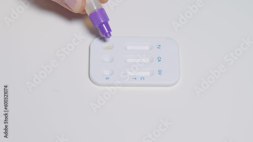 Dropping extraction solution at immunological rapid test and identify infection for self-testing at home photo