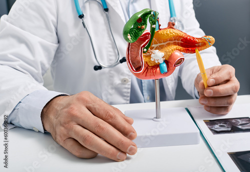 Treatment of pancreatic diseases, acute and chronic pancreatitis. Doctor showing pancreatic disease on anatomical medical model of pancreas for analysing and treatment photo