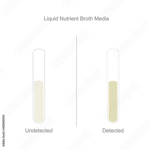 The bacteria culture in Liquid Nutrient Broth Media that shows the Undetected and Detected.