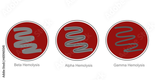 The classification bacteria growth on Blood agar that represents the hemolysis interpretation : Beta, Alpha and Gamma. photo