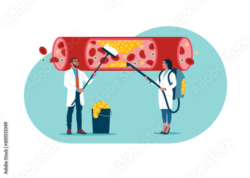 Doctors cleaning blood artery. Cleansing blood vessels and veins from cholesterol and blood cells clot. Modern vector illustration in flat style photo