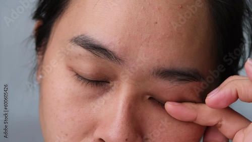 Young woman suffering from eye pain, Allergic to dust, dry eyes, watery eyes, itching. Asian woman touching eyes at home living room.