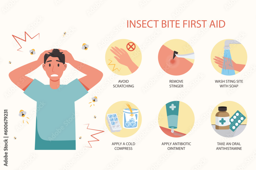 Insect bite first aid medical examination concept with people scene in the flat cartoon design. Instructions on how to provide first aid to a person who has suffered from insect bites. - obrazy, fototapety, plakaty 