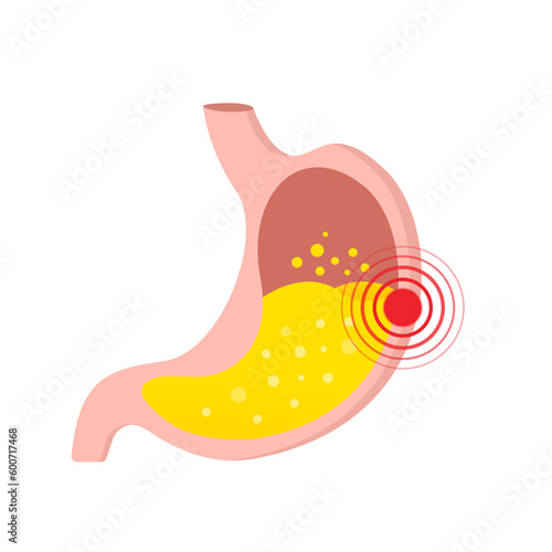 An unhealthy stomach, Nutrition, stomach pain, bloating. Human internal organs symbol. Digestive system anatomy. isolated on white background. Vector illustration