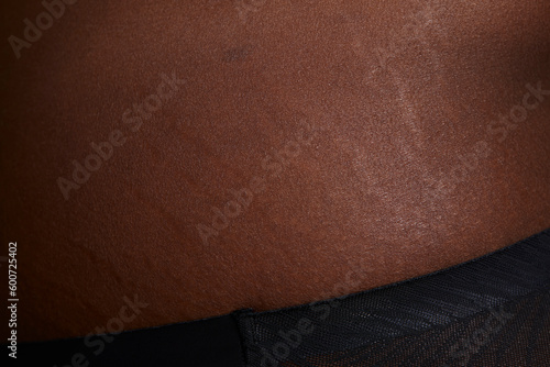 Full frame view of human skin with stretch marks