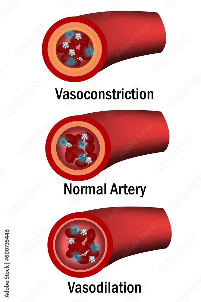 Comparison of normal, vasoconstriction and vasodilation blood vessels