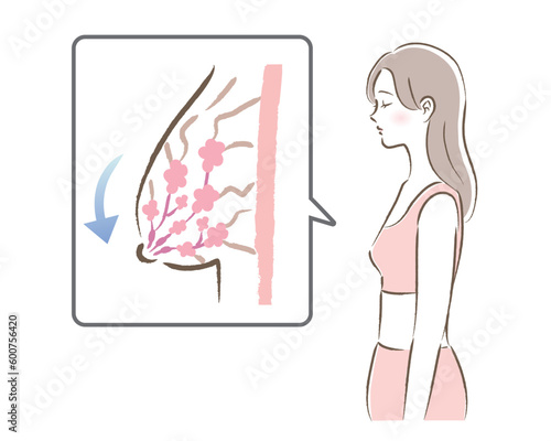 バストが垂れる図と悩む下着の女性のイラスト