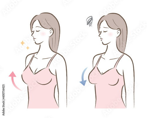 ハリのあるバストと垂れたバストの女性のイラスト　ビフォアアフター