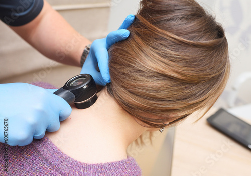 dermatologist examines a mole on the patient's neck using a special device - a dermatoscope. Prevention of skin cancer - melanoma.