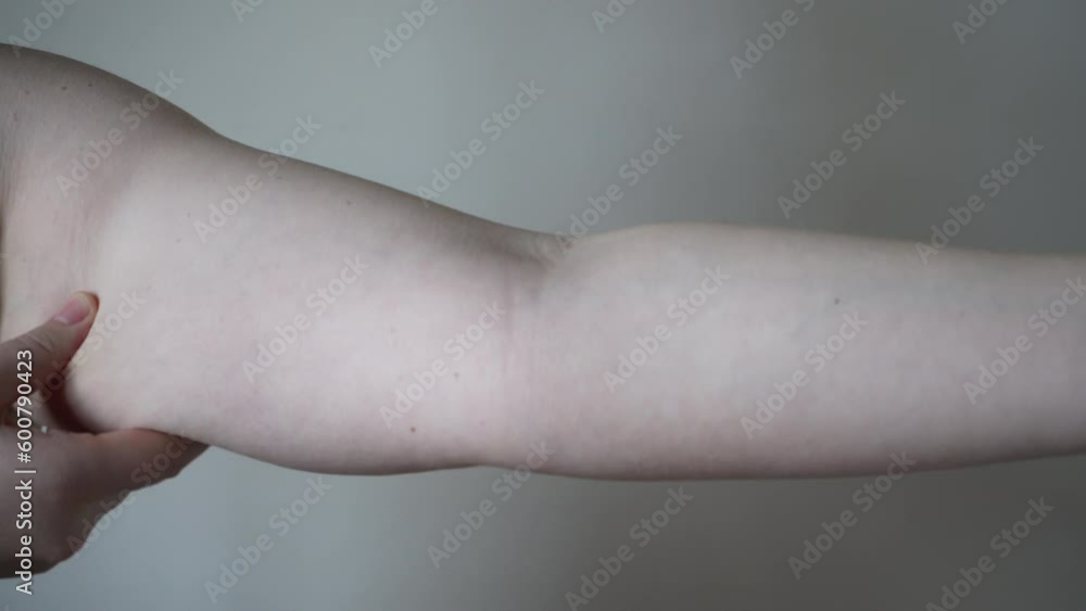 Light-skinned young woman with drooping arms. Sad bad body shape girl ...