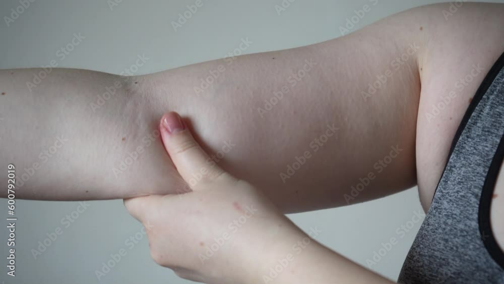 Light-skinned young woman with drooping arms. Sad bad body shape girl ...