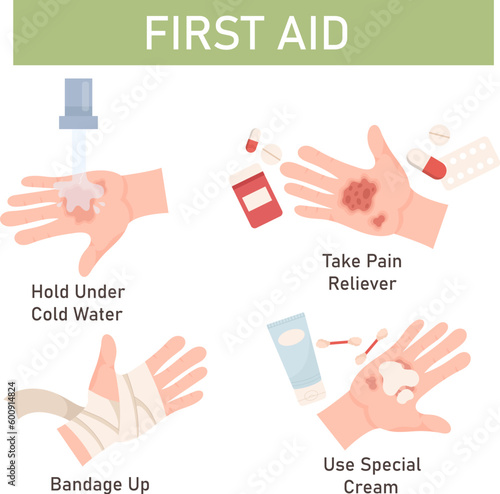 Skin Burn Treatment First Aid