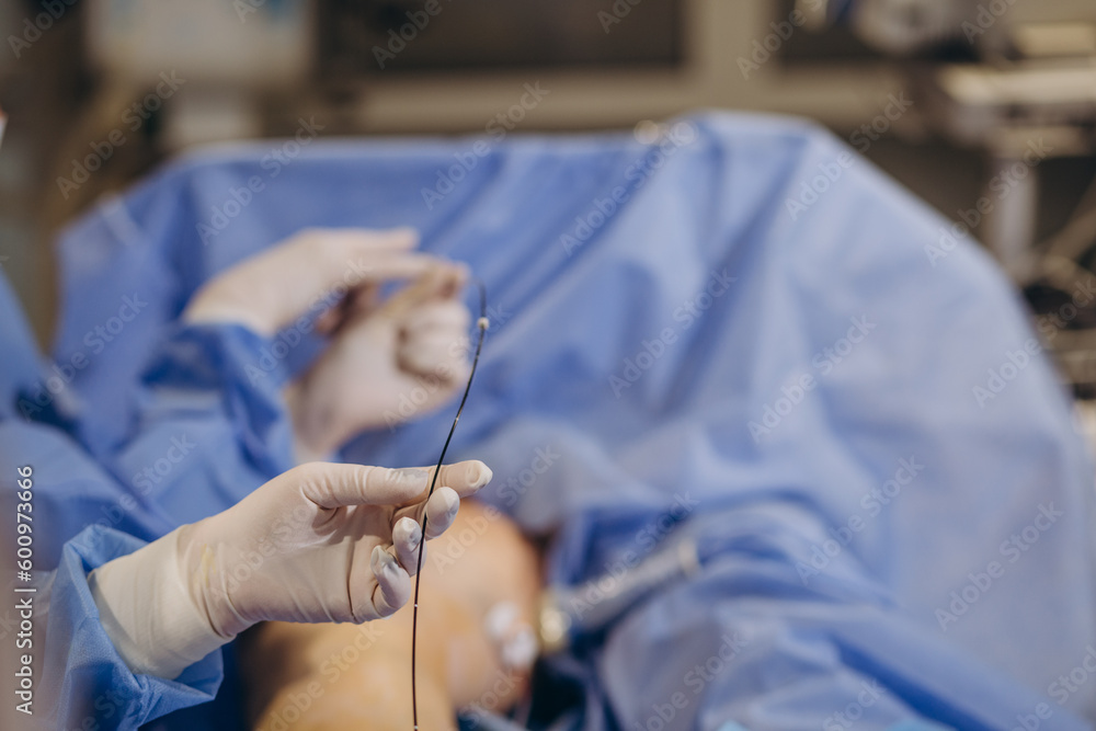 A phlebologist performs an ultrasound of the legs for varicose veins using a modern. A phlebologist performs an ultrasound of the legs for varicose veins using a modern.