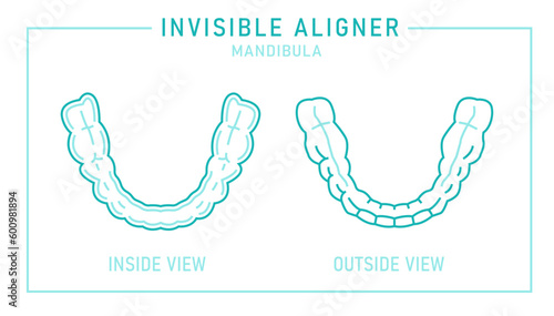 Orthodontic silicone trainer. Invisible braces aligner, retainer.