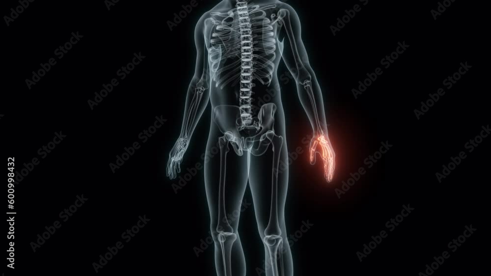 3D Rendering of a Medical Animation of the Wrist. X-ray of the Wrist. 3D Rendering of a Medical Animation of the Wrist. X-ray of the Wrist.