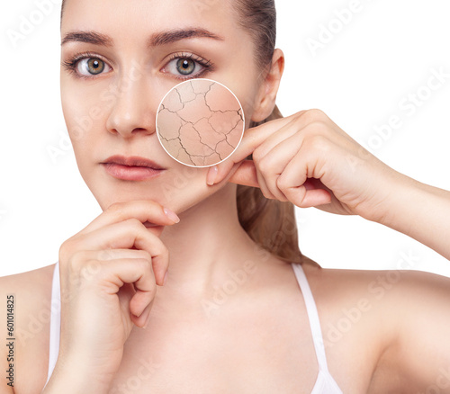 Young woman shows dry skin in zoom circle before moistening.