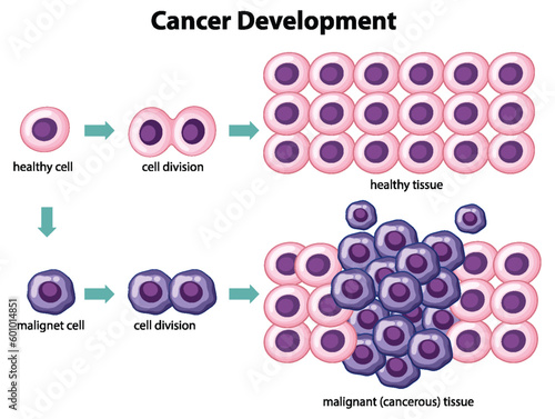 Cancer Development vector with information