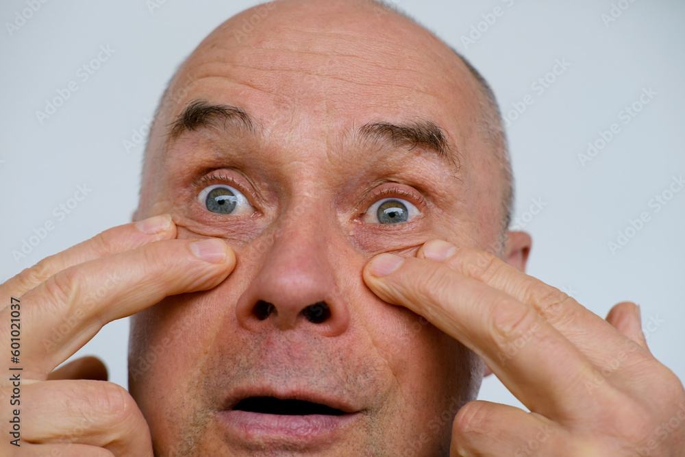 Obraz premium close-up of mature man, senior 60 years old looks carefully examines wrinkles around eyes, skin between eyebrows, age-related changes, aesthetic injection cosmetology, care anti-aging procedures