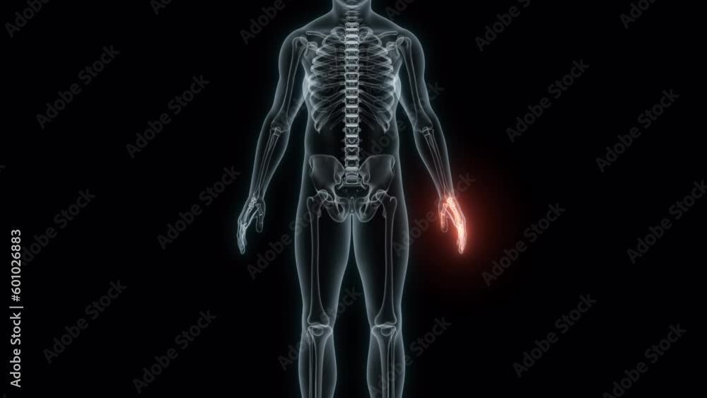 3D Rendering of a Medical Animation of the Wrist. X-ray of the Wrist. 3D Rendering of a Medical Animation of the Wrist. X-ray of the Wrist.