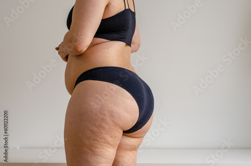 Overweighted woman wearing bikini seen from back