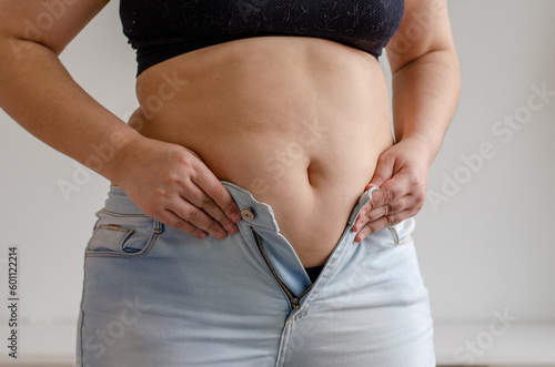 Canvas-taulu fat woman trying to zip up her jeans pants