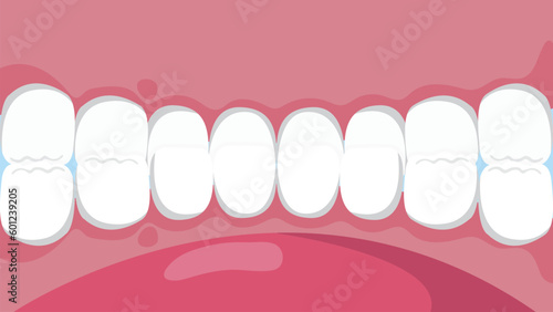 Healthy Teeth Inside View an Open Jaw Dental Care and Orthodontic Concept