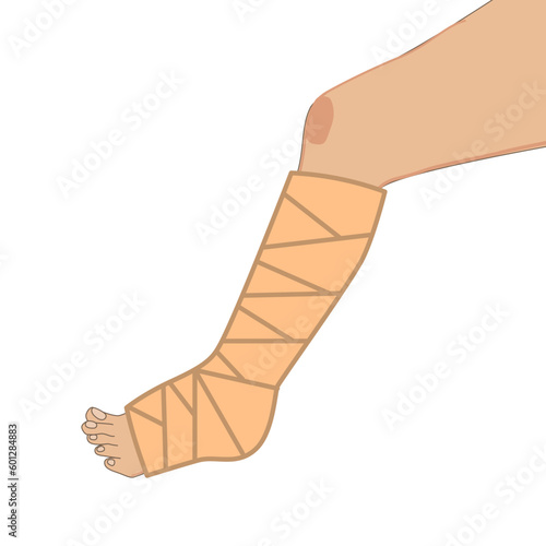Broken leg in bandage icon, injured foot in bandage, orthopedic gypsum, trauma bone, cartoon style sign on white background - editable vector illustration eps 10.