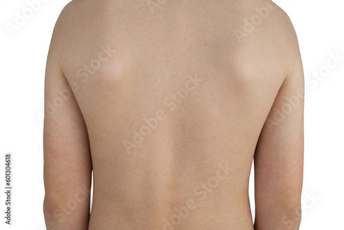 Rear view photo of a naked back of a boy isolated on white background. Beautiful posture.